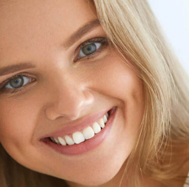 Girl After Teeth Whitening Treatment | 3rd & Columbia Dental