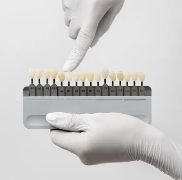 dental veneers in Seattle